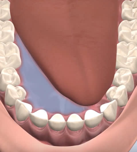 Illustration of oral pathology